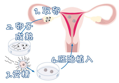 供卵代孕要多少费用